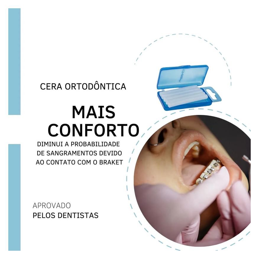 Ortodôntica Cera para Aparelho Proteção Labios 50 Bastões
