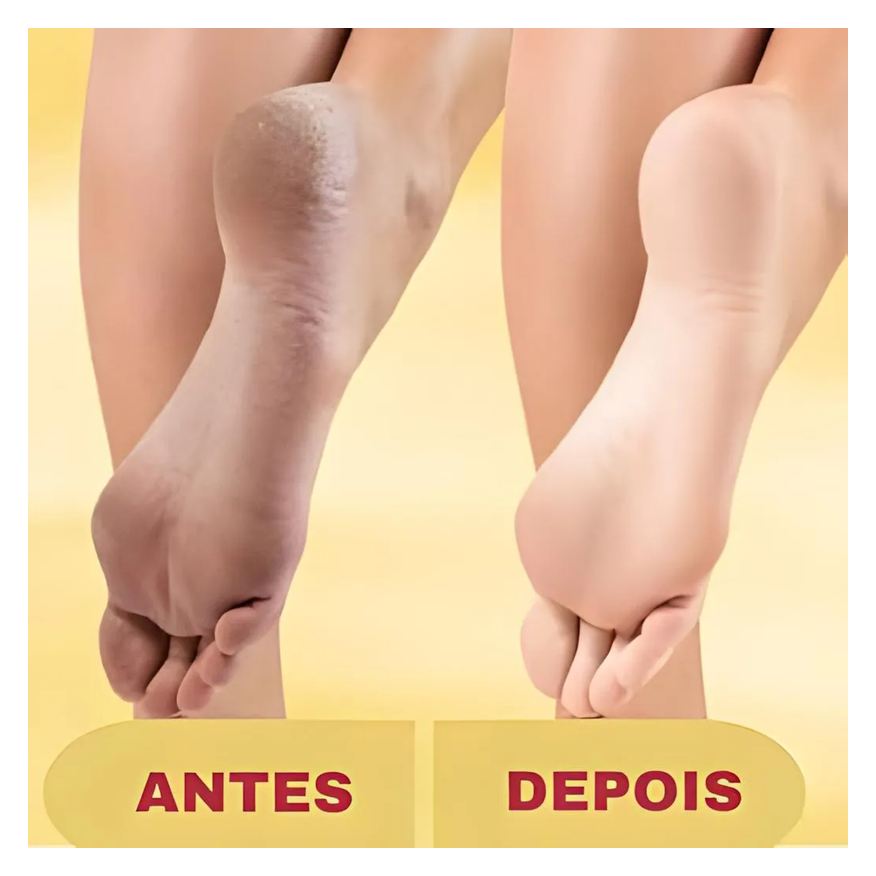 Elétrica Lixa Esfoliador Pés Recarregável Removedor de Calos + Creme Hidratante
