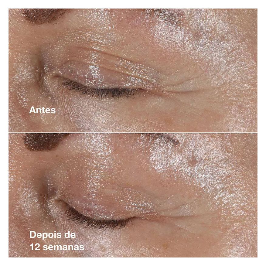 Clinique Creme Antirrugas Smart Repair Para Área dos Olhos 15ml